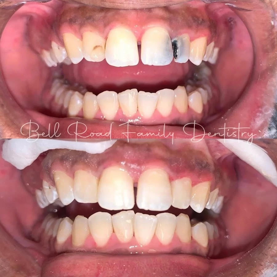 Bell Road Family Dentistry - Montgomery Picture 5