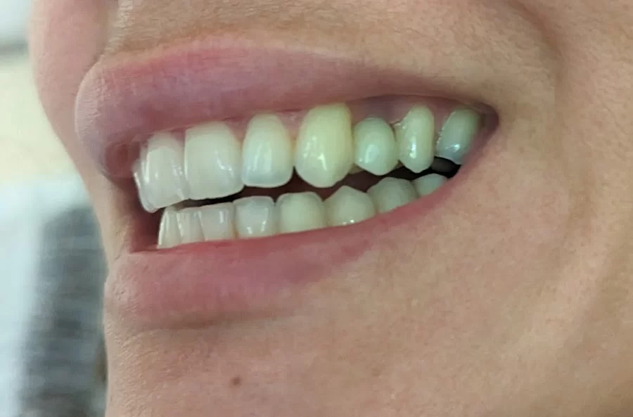 Ganji Dental | Hawthorne Dentist Picture 2