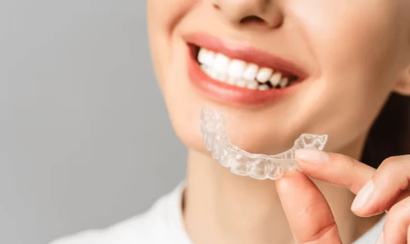 Clear Aligners for Teens and Adults: The Ultimate Guide to Straightening Teeth