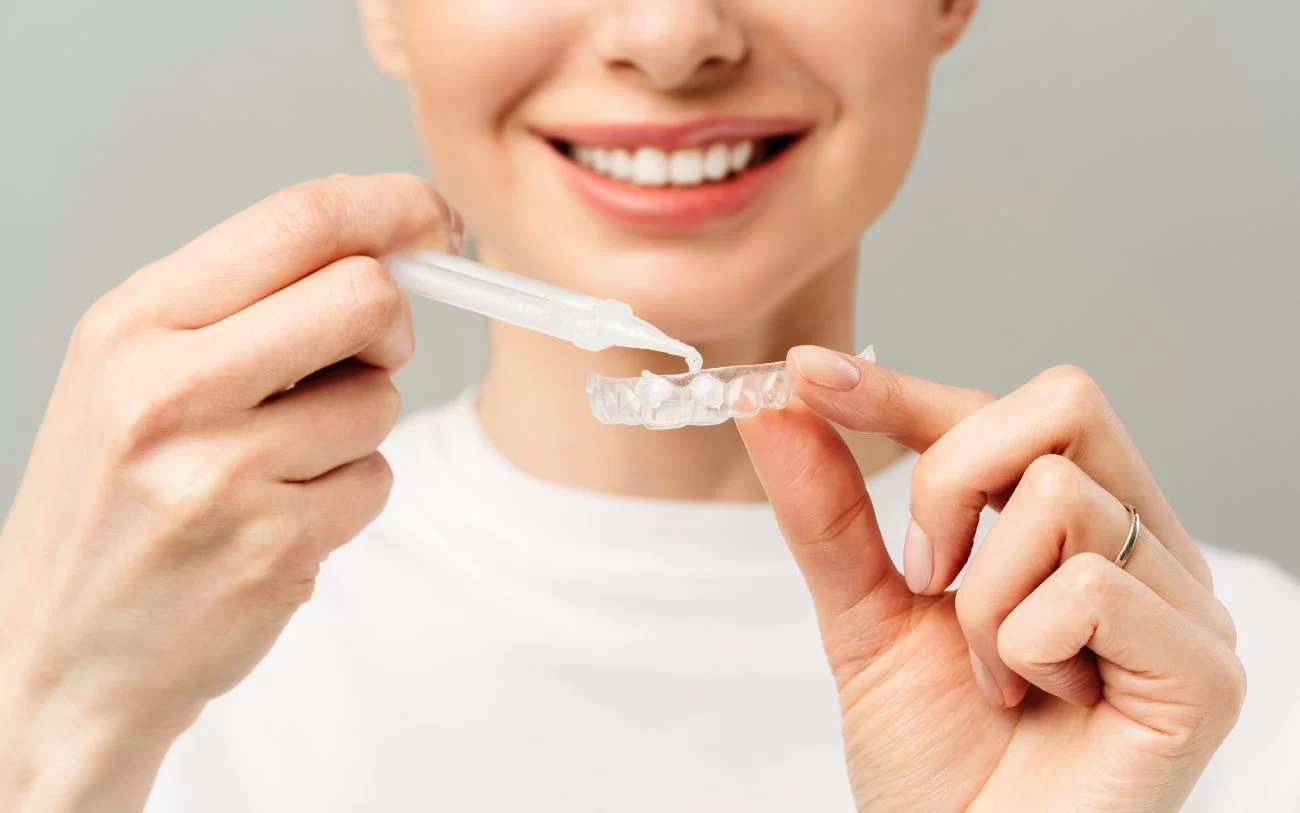 Professional Teeth Whitening vs Over-the-Counter Products: Comprehensive Comparison