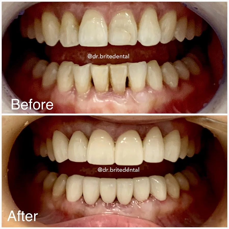 Brite Dental Picture 7