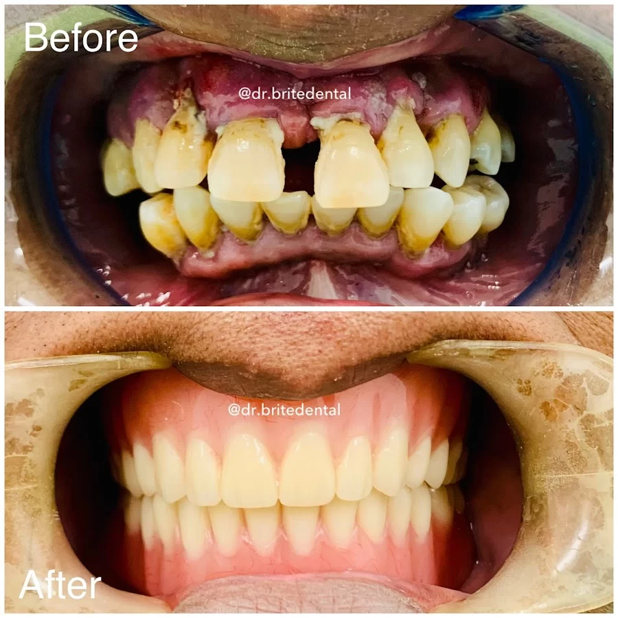 Brite Dental Picture 9