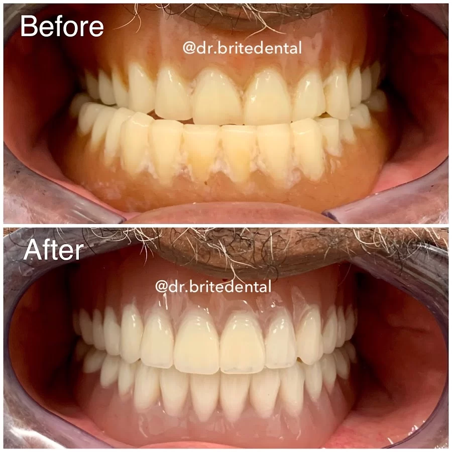 Brite Dental Picture 5