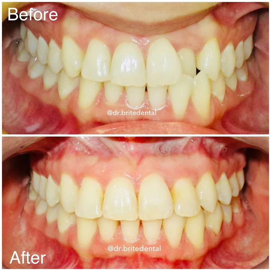 Brite Dental Picture 6