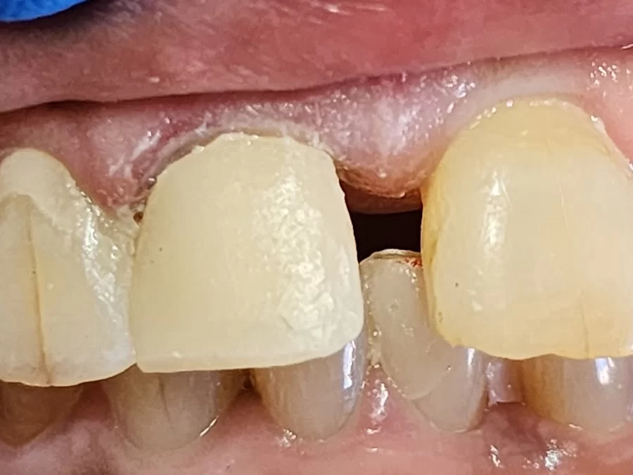 Crenshaw Professional Dental Center James T. Black DDS Picture 4