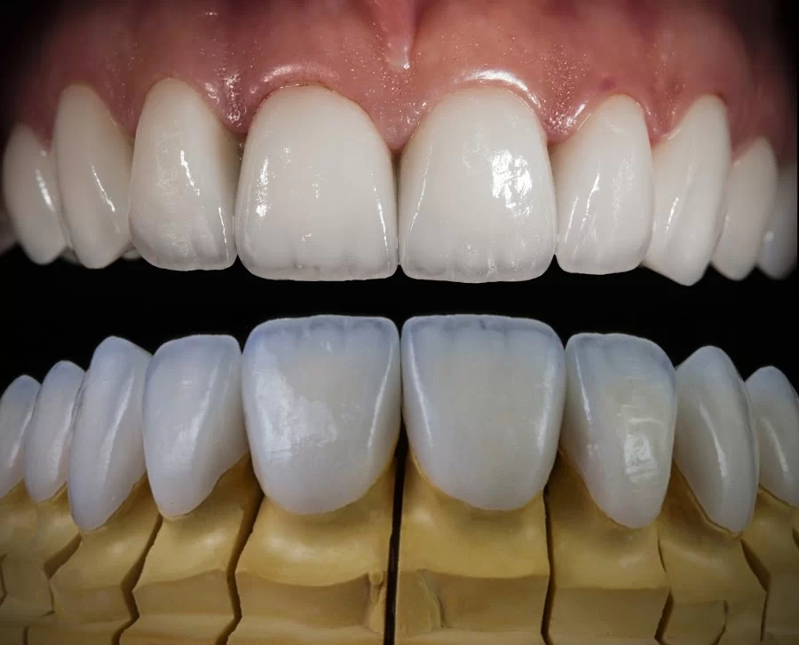 Dr. Gerard S. Frankel, DDS Picture 2