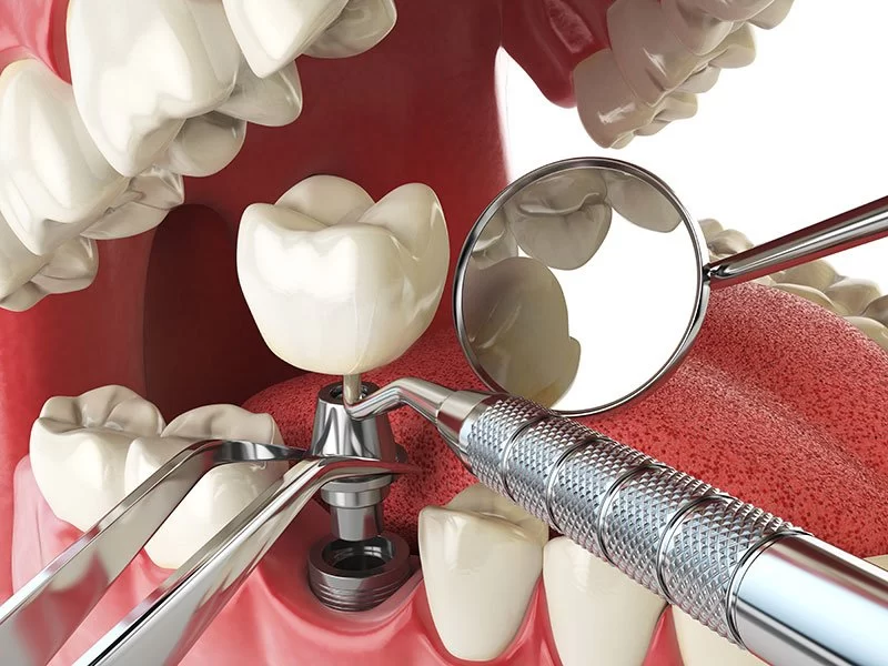 Century Smile Dental Picture 9