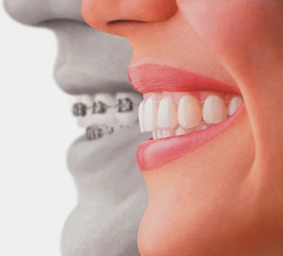 Forever Smile Dental Care Picture 1