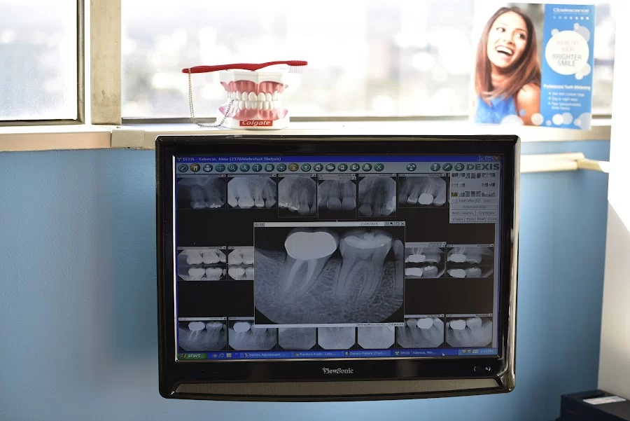 Forever Smile Dental Care Picture 8