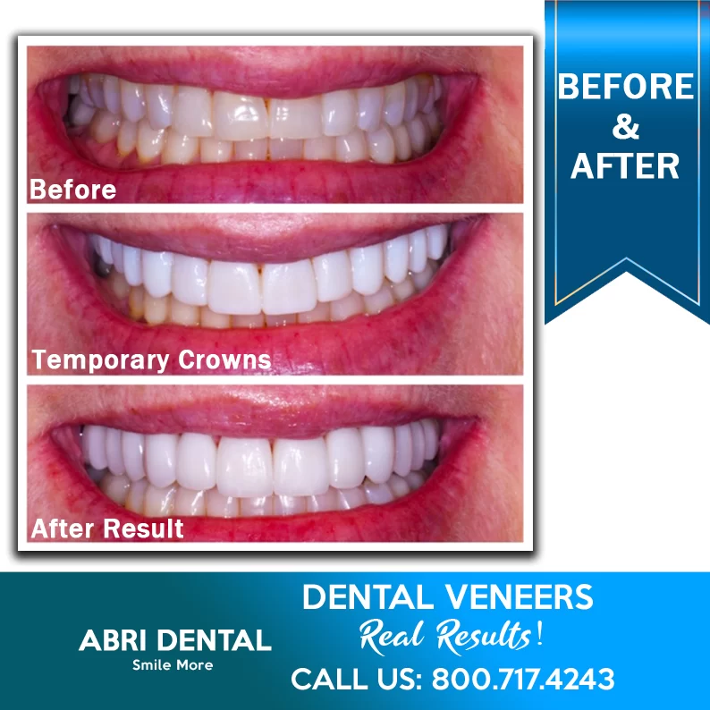 Abri Dental Picture 10