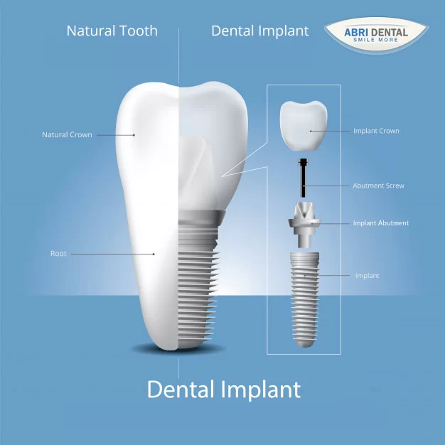 Abri Dental Picture 3