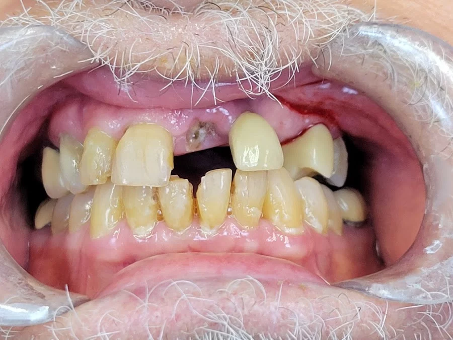 Smile Cape Coral Picture 4