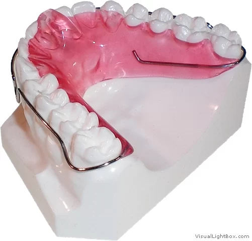 Precision Orthodontic Laboratory Picture 1