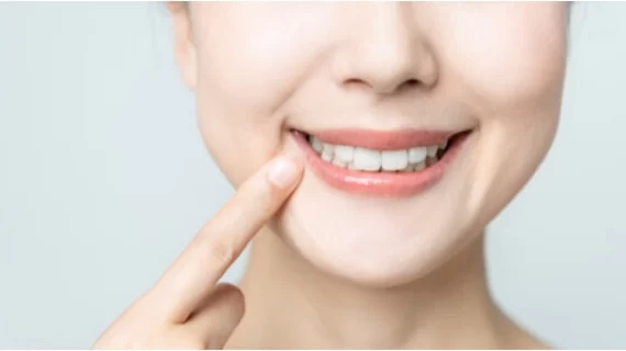 Signs You Need a Root Canal Treatment: How to Identify the Warning Signs Early