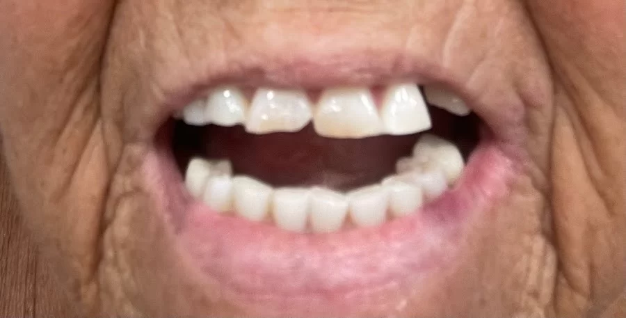Great Expressions Dental Centers - College Picture 2