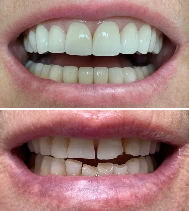 Sterling Smile Dental Care Picture 4