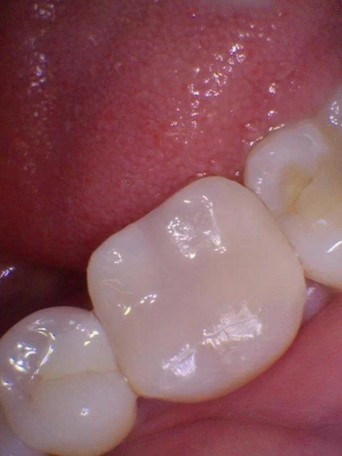 Sterling Smile Dental Care Picture 1
