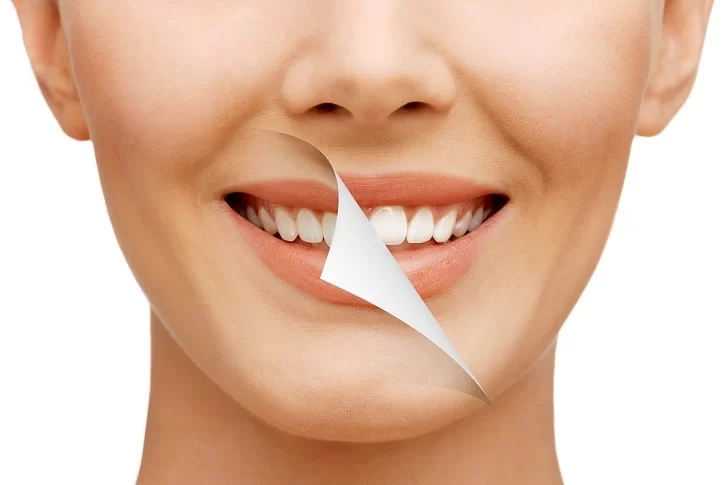 Best Cosmetic Dentist for Teeth Alignment in Houston: Achieve a Perfect Smile