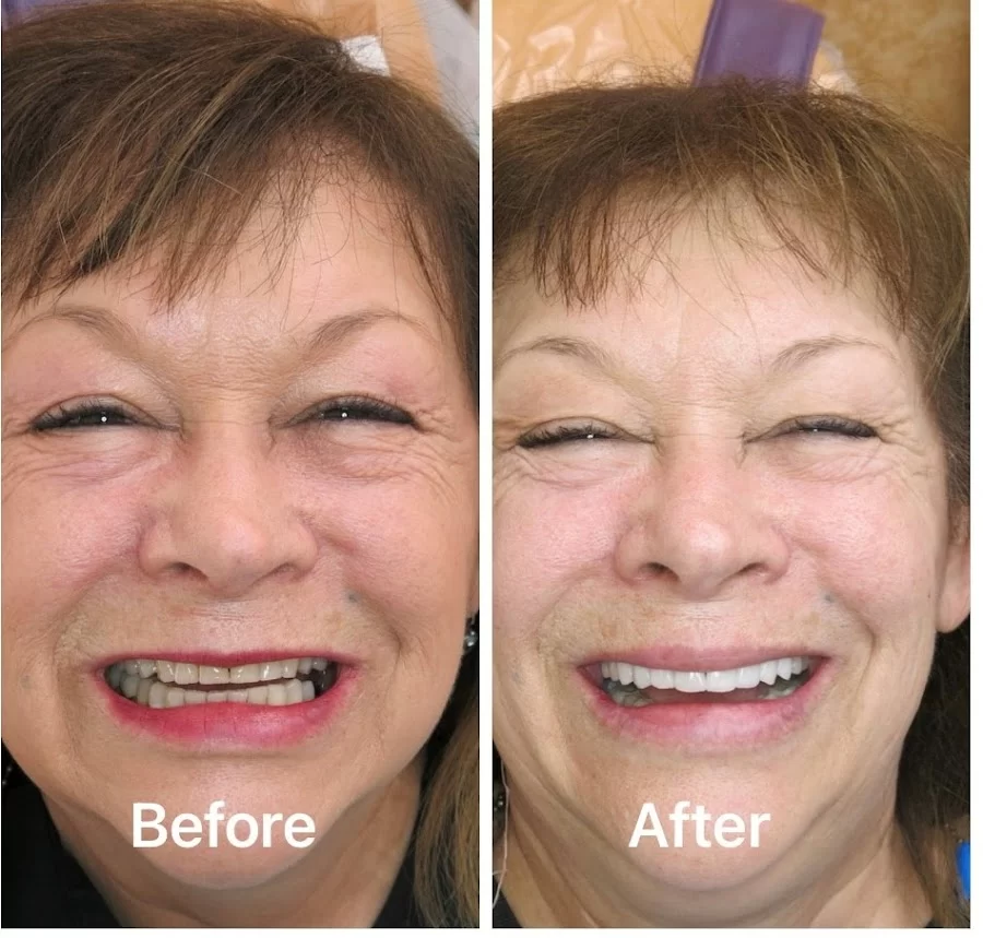 First Dental Implant Center Picture 5