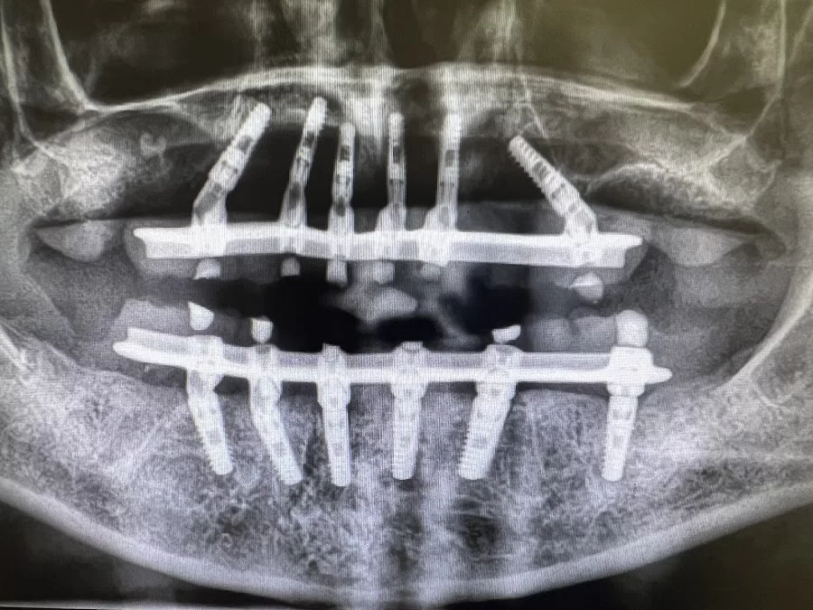 First Dental Implant Center Picture 6