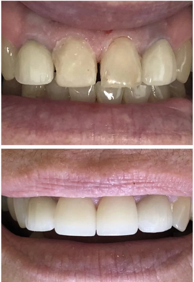 Lakeview Family Dental Picture 10