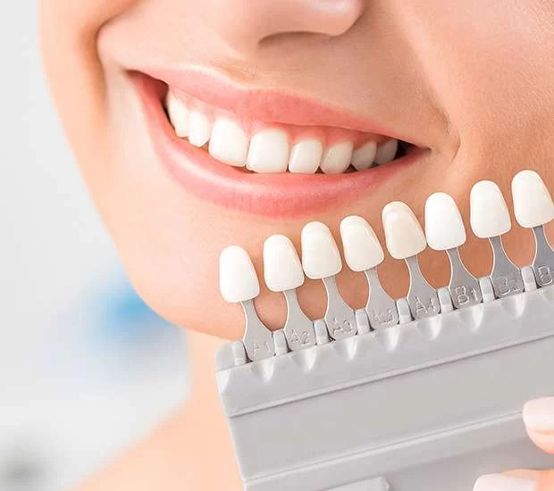 Best Cosmetic Dentist for Smile Makeover in San Francisco: Transform Your Smile Today