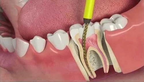 San Fernando & Pacoima Family Dental Picture 1