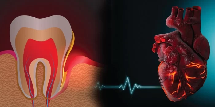 Comprehensive Dental Care Strategies for Heart Disease Patients: Protecting Your Oral and Cardiac Health
