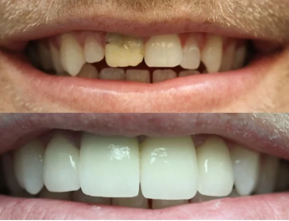 Smile Works Dentistry & Orthodontics in La Mirada Picture 3
