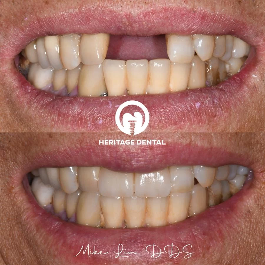 Heritage Dental Picture 10