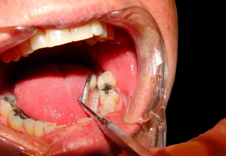 Gilbert Vista Dental Picture 6