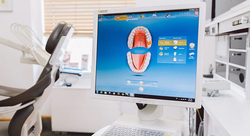 Dental Crown in an Hour: Fort Myers Picture 3