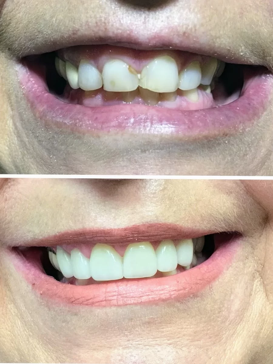 One Stop Dental Picture 10