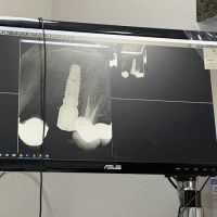 East Valley Periodontics ico