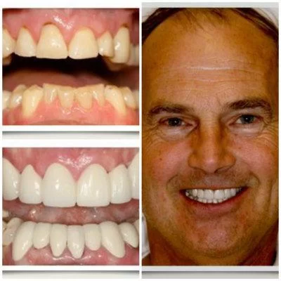 Aspen Ridge Dental Care Picture 3