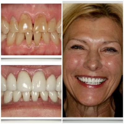 Aspen Ridge Dental Care Picture 4