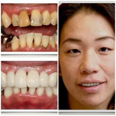 Aspen Ridge Dental Care Picture 2