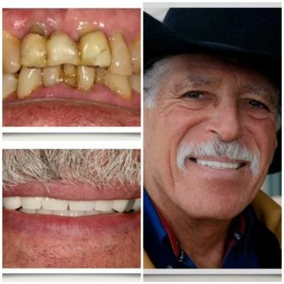 Aspen Ridge Dental Care Picture 5