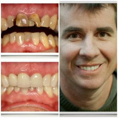Aspen Ridge Dental Care Picture 1