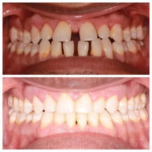 Wade Orthodontics Columbus West Picture 1