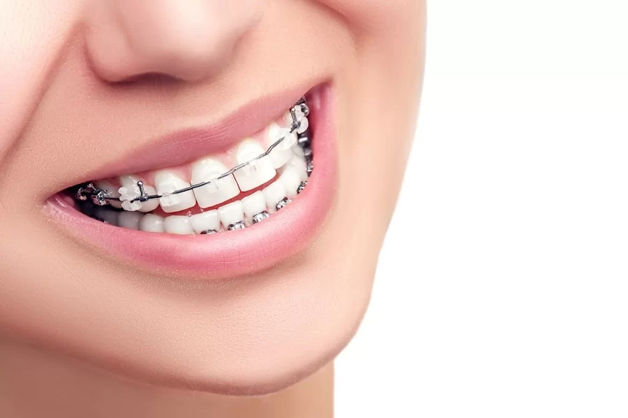 Elison & Wood Orthodontics Picture 1