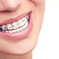 Elison & Wood Orthodontics ico