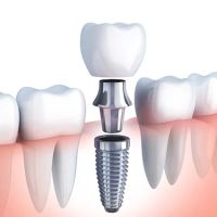 Tru-Value Dental and Denture ico