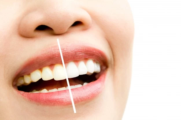 Island Dental - Dentist Gilbert, AZ Picture 4