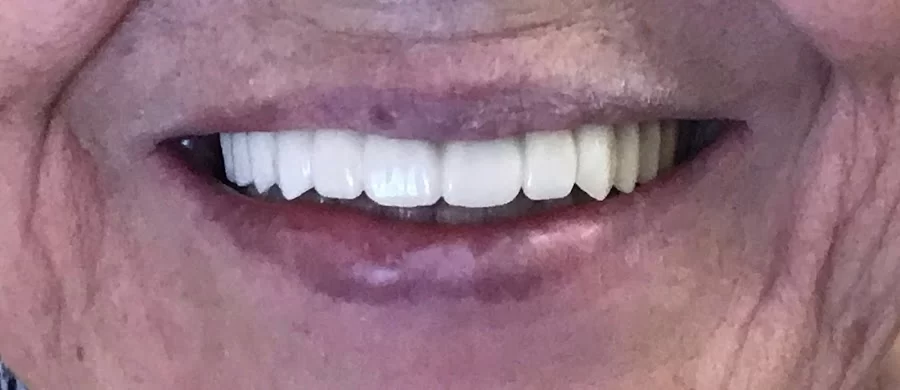 San Tan Smiles Picture 2