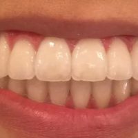 San Tan Smiles ico