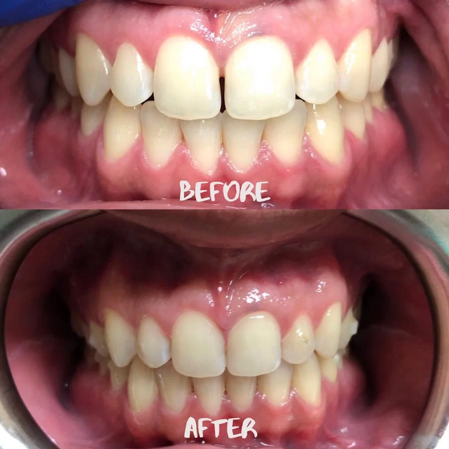 Bedford Dental & Braces Picture 10