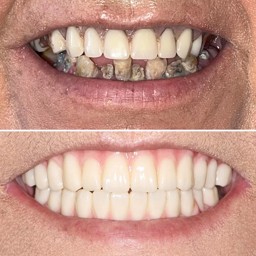 Itani Dental San Francisco Picture 7
