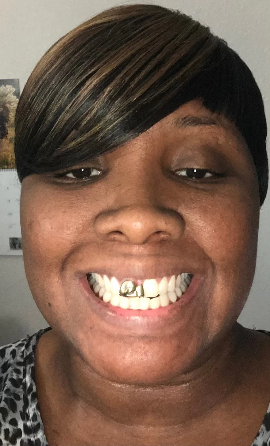 Happy Molar Dental Picture 6