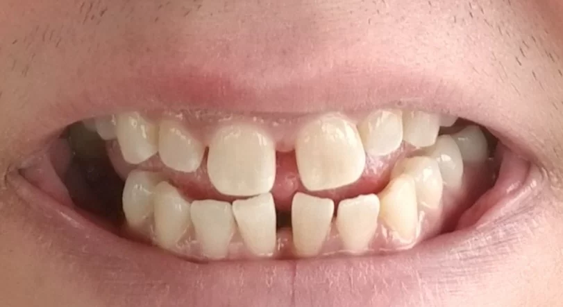 Gentle Dental Picture 4